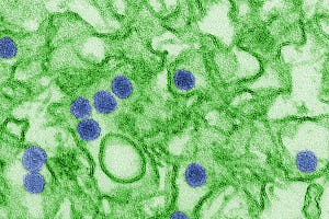 Digitaal ingekleurde TEM-afbeelding van het Zika-virus.