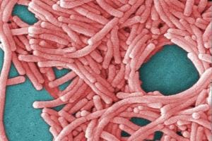 Nieuwe testmethode versnelt detectie Legionella